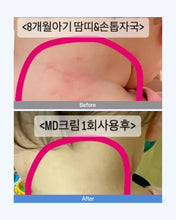 Load image into Gallery viewer, Dermaim MD cream 더마에임 MD크림 (10+2)