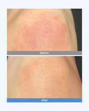 Load image into Gallery viewer, Dermaim MD cream 더마에임 MD크림 (10+2)