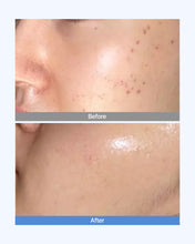 Load image into Gallery viewer, Dermaim MD cream 더마에임 MD크림 (10+2)