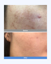 Load image into Gallery viewer, Dermaim MD cream 더마에임 MD크림 (10+2)