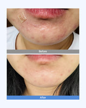 Load image into Gallery viewer, Dermaim MD cream 더마에임 MD크림 (10+2)