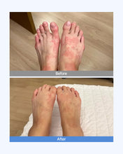 Load image into Gallery viewer, Dermaim MD cream 더마에임 MD크림 (10+2)