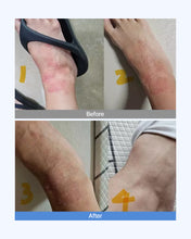 Load image into Gallery viewer, Dermaim MD cream 더마에임 MD크림 (10+2)