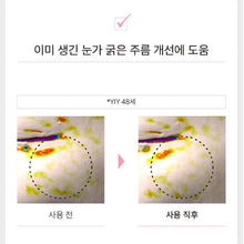 Load image into Gallery viewer, -Franz Naked Sunshield peptide patch 프란츠 네이키드 선샤인 투명선패치 5회분 (5+1 프로모션)